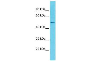 Host:  Rabbit  Target Name:  Etv3  Sample Type:  Mouse Testis lysates  Antibody Dilution:  1. (ETV3 抗体  (C-Term))