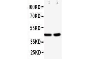 Western Blotting (WB) image for anti-Branched Chain Amino-Acid Transaminase 1, Cytosolic (BCAT1) (AA 360-375), (C-Term) antibody (ABIN3044434)