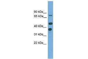 WB Suggested Anti-PTPN11 Antibody Titration: 0. (PTPN11 抗体  (N-Term))