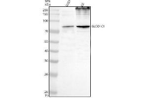 anti-Solute Carrier Organic Anion Transporter Family, Member 1C1 (SLCO1C1) (AA 1-712) antibody
