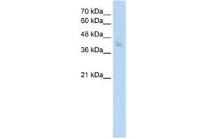 Human MCF7; WB Suggested Anti-SPDEF Antibody Titration: 2. (SPDEF/PSE 抗体  (N-Term))