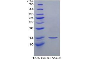 SDS-PAGE analysis of Mouse MFAP5 Protein. (MFAP5 蛋白)