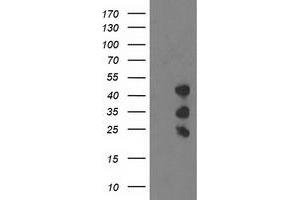 Western Blotting (WB) image for anti-PDZ and LIM Domain 2 (PDLIM2) antibody (ABIN1500129) (PDLIM2 抗体)