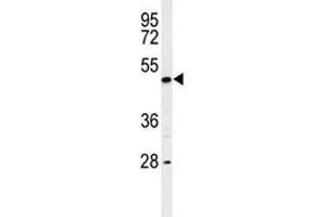 Western blot analysis of RIPK3 antibody and K562 lysate. (RIPK3 抗体  (AA 489-518))
