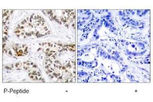Image no. 2 for anti-V-Rel Reticuloendotheliosis Viral Oncogene Homolog B (RELB) (pSer552) antibody (ABIN197017) (RELB 抗体  (pSer552))