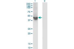 Western Blot analysis of WDR4 expression in transfected 293T cell line by WDR4 monoclonal antibody (M01), clone 1F9.