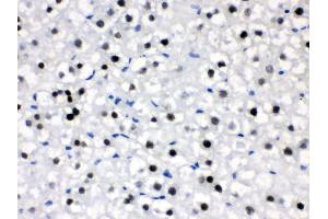 Anti- CRY2 Picoband antibody,IHC(P) IHC(P): Rat Liver Tissue (CRY2 抗体  (N-Term))
