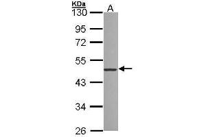 WB Image Sample (30 ug of whole cell lysate) A: 293T 10% SDS PAGE antibody diluted at 1:1000 (ZNF277 抗体)