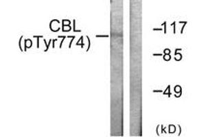 Western blot analysis of extracts from HeLa cells treated with EGF 200ng/ml 30', using CBL (Phospho-Tyr774) Antibody. (CBL 抗体  (pTyr774))