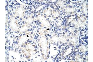 SNRPA1 antibody was used for immunohistochemistry at a concentration of 4-8 ug/ml to stain Epithelial cells of renal tubule (arrows) in Human Kidney. (SNRPA1 抗体  (C-Term))