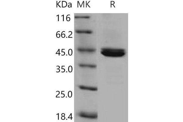 CPB1 Protein (His tag)