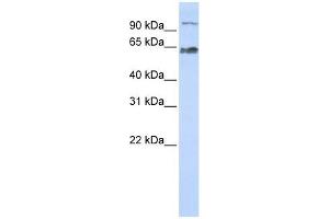 KIAA0892 antibody used at 1 ug/ml to detect target protein. (MAU2/KIAA0892 抗体  (Middle Region))