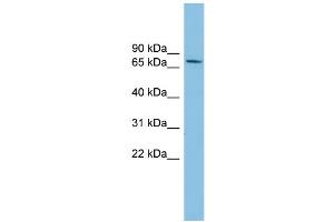 WB Suggested Anti-SENP2 Antibody Titration: 0. (SENP2 抗体  (Middle Region))