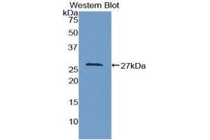 Western Blotting (WB) image for anti-Growth Arrest-Specific 2 (GAS2) (AA 64-267) antibody (ABIN3209088) (GAS2 抗体  (AA 64-267))