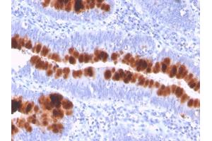 Formalin-fixed, paraffin-embedded human colon stained with CD95 Mouse Monoclonal Antibody (FAS/3112).