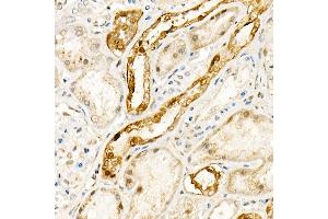 Immunohistochemistry (IHC) image for anti-NADPH Oxidase 4 (NOX4) (AA 328-578) antibody (ABIN6144752)