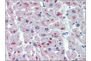 Immunohistochemistry (IHC) image for anti-N-Acylsphingosine Amidohydrolase (Acid Ceramidase) 1 (ASAH1) (AA 25-125) antibody (ABIN782337) (ASAH1 抗体  (AA 25-125))