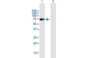Western Blot analysis of PIAS1 expression in transfected 293T cell line by PIAS1 MaxPab polyclonal antibody. (PIAS1 抗体  (AA 1-651))
