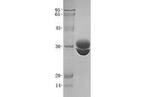 Validation with Western Blot (F11R 蛋白)