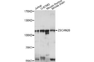 Western blot analysis of extracts of various cell lines, using ZSCAN20 antibody (ABIN6291081) at 1:1000 dilution. (ZSCAN20 抗体)