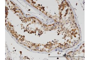 Immunoperoxidase of monoclonal antibody to ZBP1 on formalin-fixed paraffin-embedded human testis. (ZBP1 抗体  (AA 2-100))