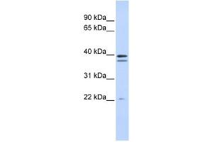 RABGGTB antibody used at 1 ug/ml to detect target protein. (RABGGTB 抗体  (Middle Region))