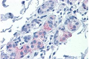 Human Breast: Formalin-Fixed, Paraffin-Embedded (FFPE) (Claudin 1 抗体  (AA 1-212))