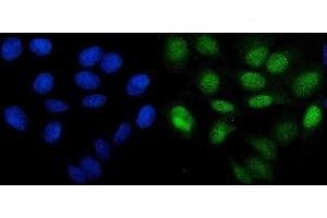 IF analysis of PHF21B using anti-PHF21B antibody (ABIN7601150). (PHF21B 抗体  (AA 291-499))