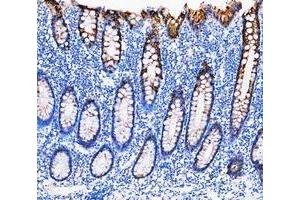 IHC analysis of Cytokeratin 20/Krt20 using anti-Cytokeratin 20/Krt20 antibody (ABIN7601133). (KRT20 抗体  (AA 29-431))