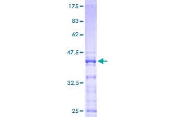 RPS25 Protein (AA 1-125) (GST tag)