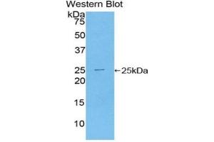 Western blot analysis of the recombinant protein. (TICAM2 抗体  (AA 34-241))