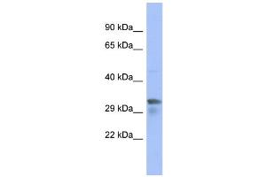 WB Suggested Anti-PIM1 Antibody Titration: 0. (PIM1 抗体  (N-Term))