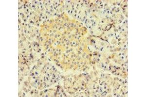 Immunohistochemistry (IHC) image for anti-Recombination Signal Binding Protein For Immunoglobulin kappa J Region (RBPJ) (AA 243-485) antibody (ABIN7167534)