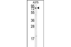 Western Blotting (WB) image for anti-X-Ray Repair Complementing Defective Repair in Chinese Hamster Cells 1 (XRCC1) (AA 407-435) antibody (ABIN651735)