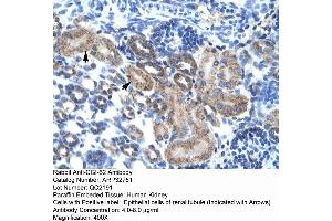 Human kidney (FAM164A 抗体  (C-Term))