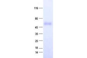 Western Blotting (WB) image for Zinc Finger Protein 566 (ZNF566) protein (His tag) (ABIN2736069)
