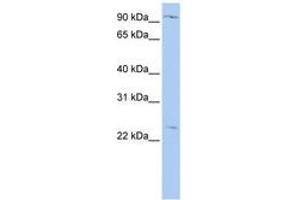 Image no. 1 for anti-Oxysterol Binding Protein-Like 8 (OSBPL8) (N-Term) antibody (ABIN6740875) (OSBPL8 抗体  (N-Term))
