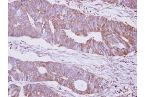 Image no. 1 for anti-Mannosidase, Alpha, Class 2B, Member 2 (MAN2B2) (N-Term) antibody (ABIN1494047) (MAN2B2 抗体  (N-Term))