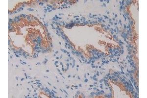 Detection of CD26 in Human Prostate Tissue using Polyclonal Antibody to Cluster Of Differentiation 26 (CD26)