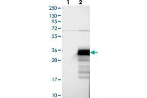 Western blot analysis of Lane 1: Negative control (vector only transfected HEK293T lysate), Lane 2: Over-expression Lysate (Co-expressed with a C-terminal myc-DDK tag (~3. (ZCCHC24 抗体)