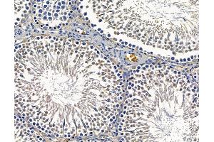 SLCO1B7 Antibody at 1/100 staining rat testis tissue by IHC-P. (LST-3TM12 抗体)