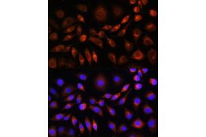 Immunofluorescence analysis of L929 cells using ApoM Rabbit pAb (ABIN6127365, ABIN6137030, ABIN6137031 and ABIN6220968) at dilution of 1:100. (Apolipoprotein M 抗体  (AA 23-188))