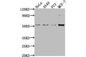 Western Blot Positive WB detected in: Hela whole cell lysate, A549 whole cell lysate, PC-3 whole cell lysate, MCF-7 whole cell lysate All lanes: FKTN antibody at 1:2000 Secondary Goat polyclonal to rabbit IgG at 1/50000 dilution Predicted band size: 54, 50 kDa Observed band size: 54 kDa (Fukutin 抗体  (AA 87-276))