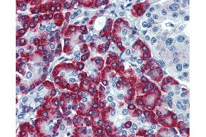 anti-Signal Sequence Receptor, alpha (SSR1) (AA 33-287) antibody