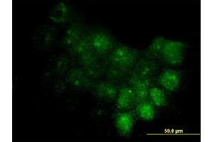 Immunofluorescence of monoclonal antibody to S100A7 on A-431 cell. (S100A7 抗体  (AA 1-101))