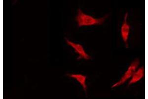 ABIN6274847 staining Hela by IF/ICC. (FAM117B 抗体  (Internal Region))