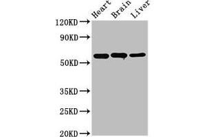 Western Blot Positive WB detected in: Rat heart tissue, Rat brain tissue, Mouse liver tissue All lanes: ALDH5A1 antibody at 3. (ALDH5A1 抗体  (AA 48-535))