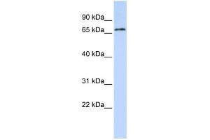 WB Suggested Anti-TRIM41 Antibody Titration:  0. (TRIM41 抗体  (C-Term))