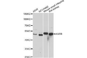 Western blot analysis of extracts of various cell lines, using AGER antibody. (RAGE 抗体)