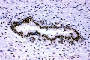 IHC analysis of p95 NBS1 using anti-p95 NBS1 antibody (ABIN3043282). (Nibrin 抗体  (C-Term))